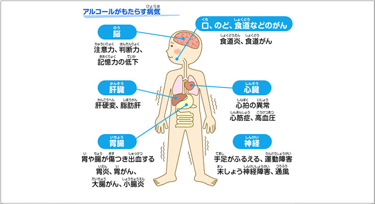 アルコールがもたらす病気